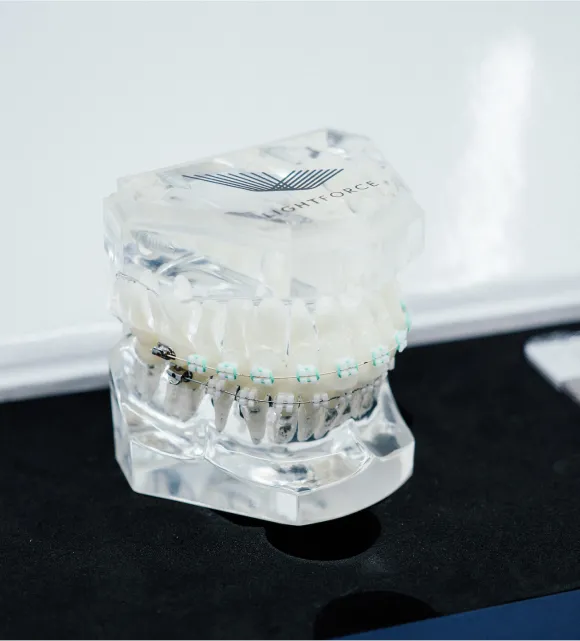 Cost of Lightforce Braces in Marlboro, NJ
