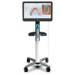 iTero digital scanner used for taking orthodontic impressions, part of the orthodontic technology at TG Orthodontics