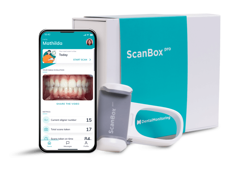 Orthodontic scan box, dental tool, and cellphone on a table.